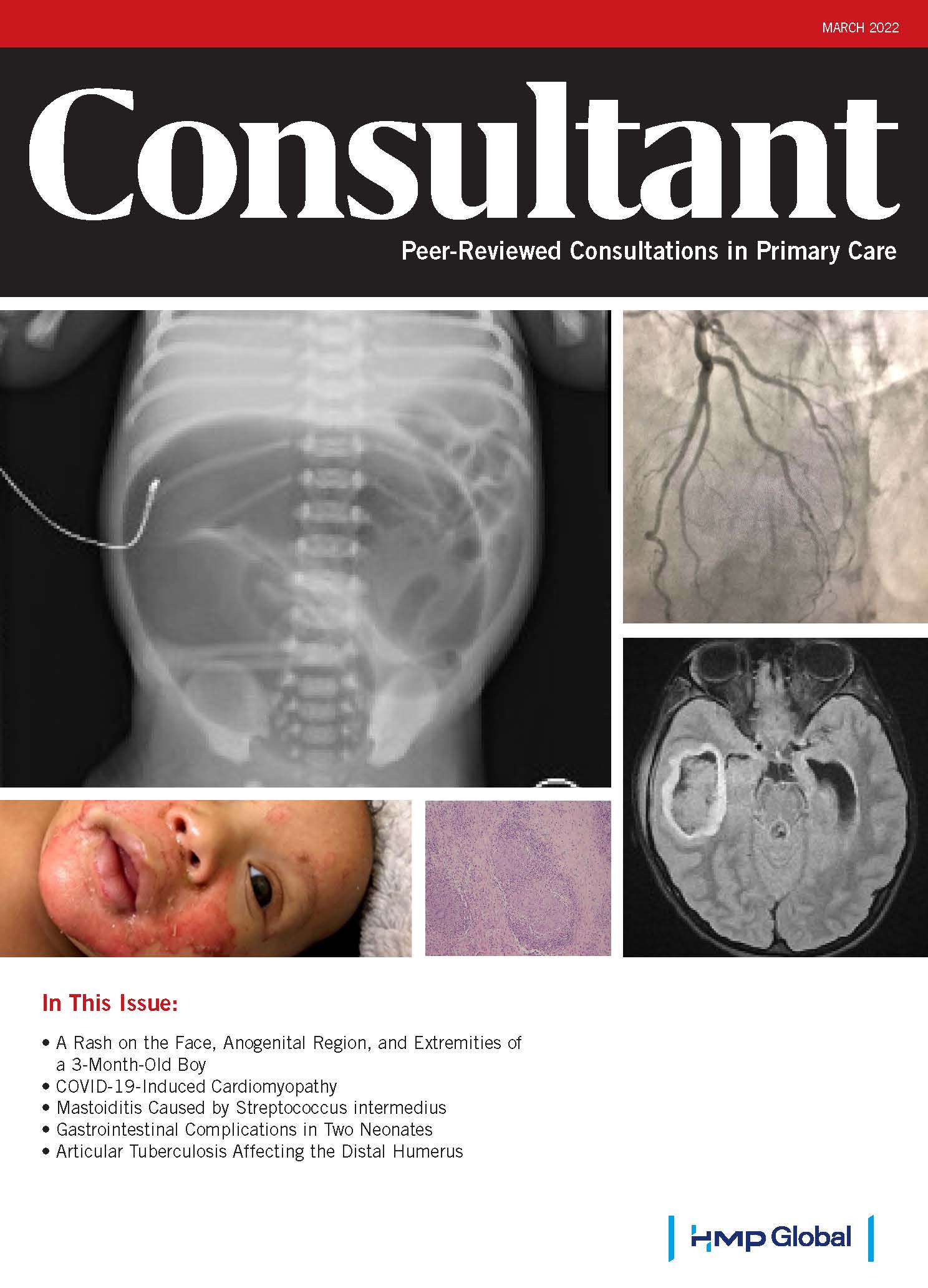 Volume 62 - Issue 3 - March 2022