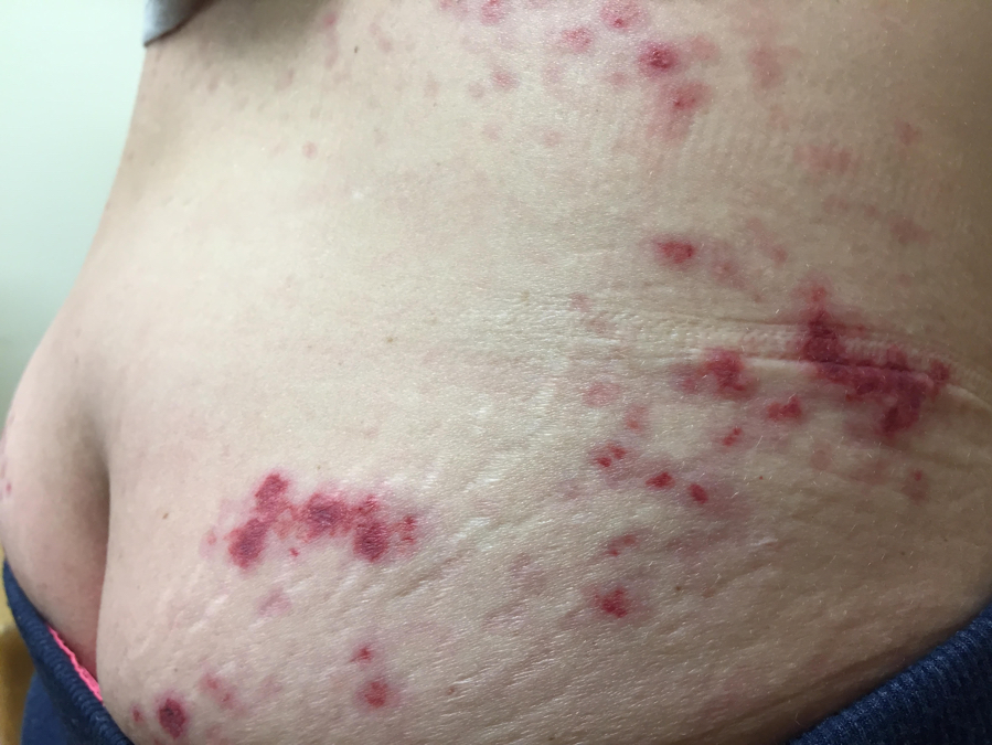 cuando consumir l carnitina L- Carnitina Cmo se toma?  A qu hora? Lo ideal es tomarla 3045  minutos antes del entrenamiento.  En ayunas o despus de comer?  En  ayunas Absorcin ms rpida. Perfecto
