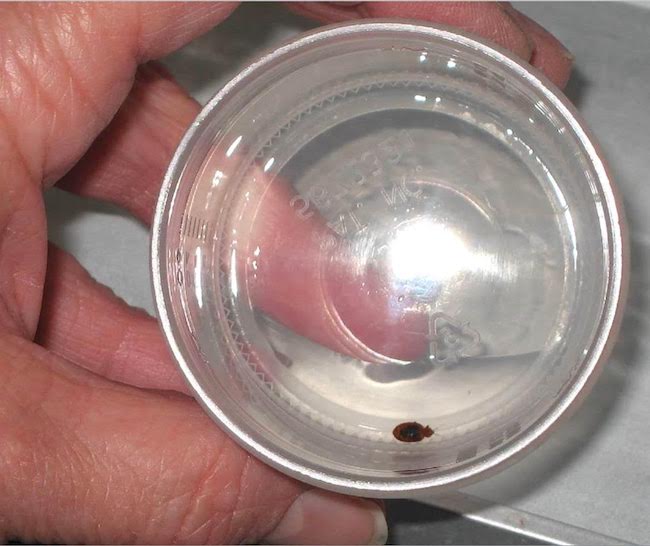 Bedbugs figure 3