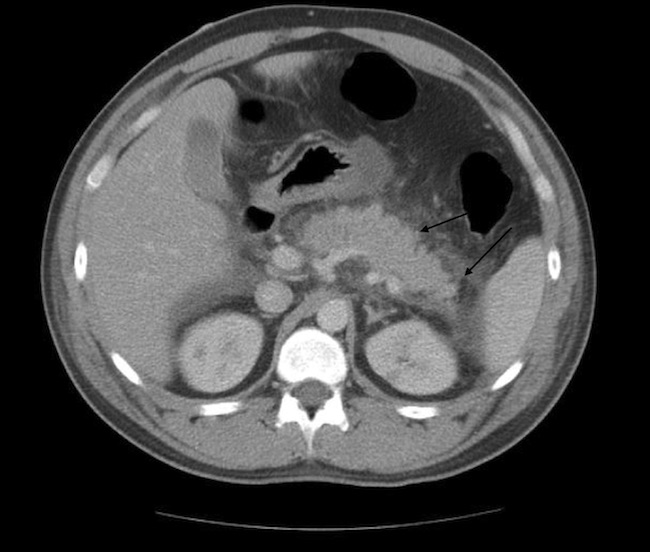 Campylobacter figure 2