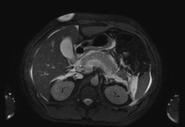 Campylobacter figure 3
