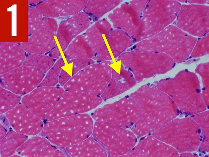 Colchicine Fig 1