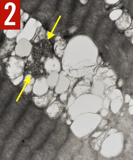 Colchicine Fig 2