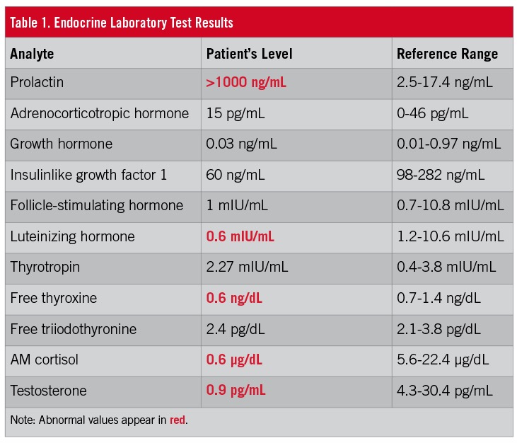 prolactinoma migraine table 1