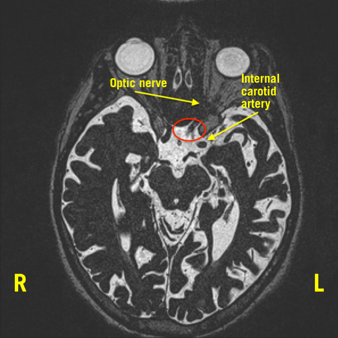 Figure 2 head MRI