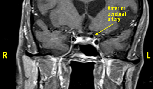 Figure 3 head MRI