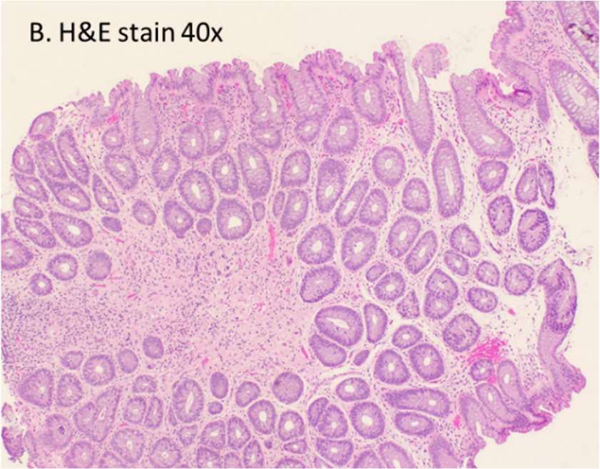 Fig 2b Histology