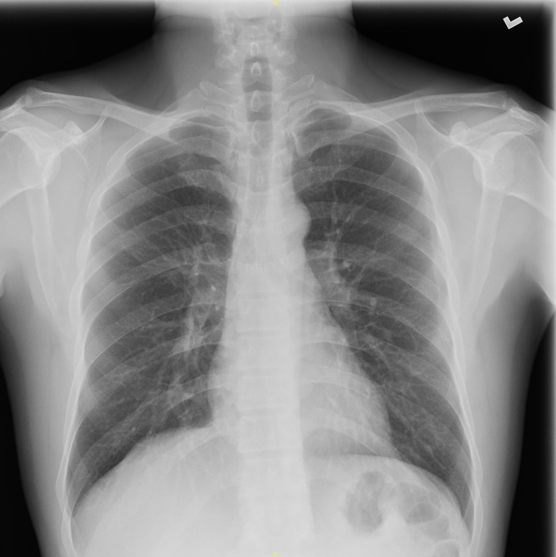 IgG4-RD Figure 1