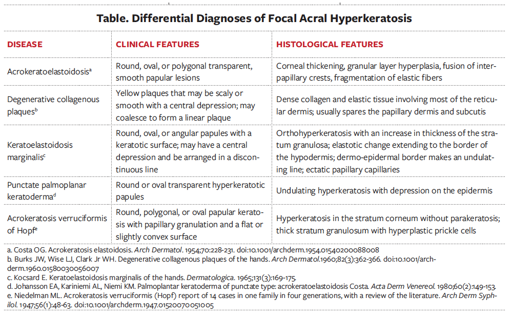 Table. Differential Diagnoses of Focal Acral Hyperkeratosis