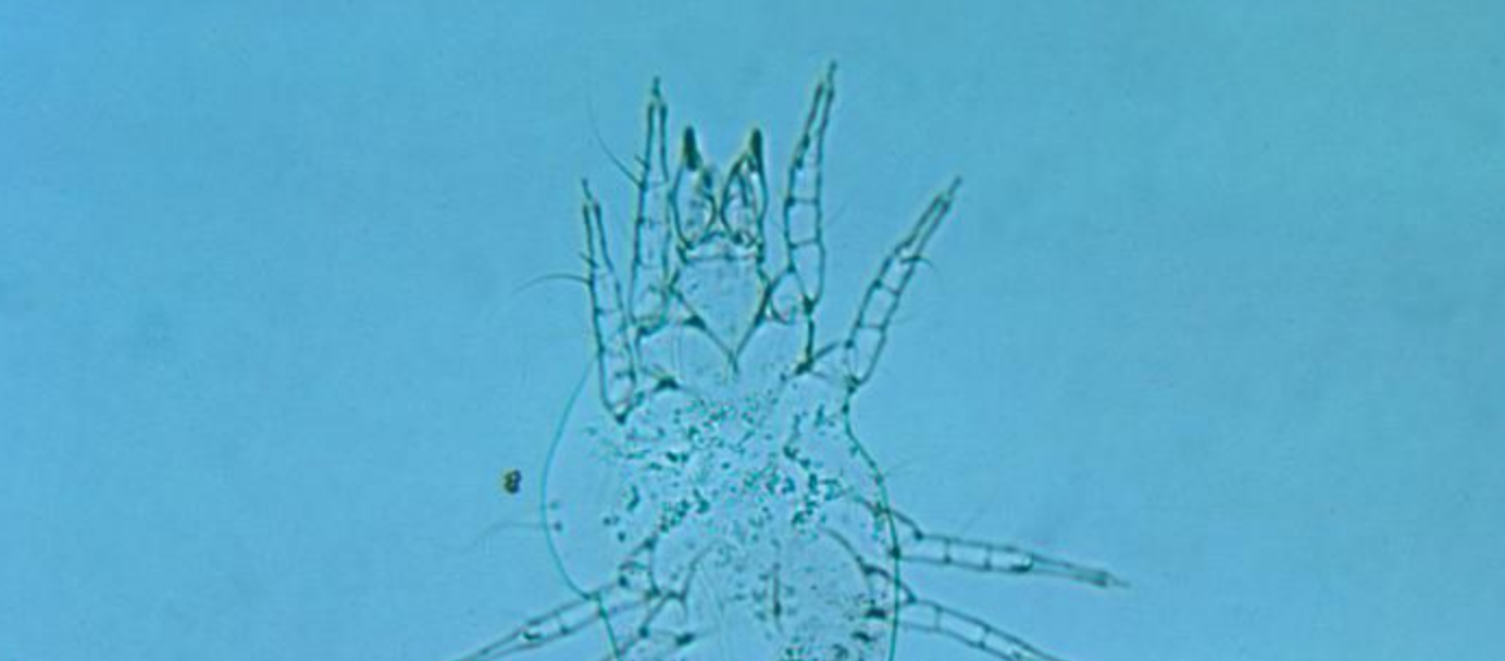 FDA New Treatment for House Dust Mite Allergies Consultant360