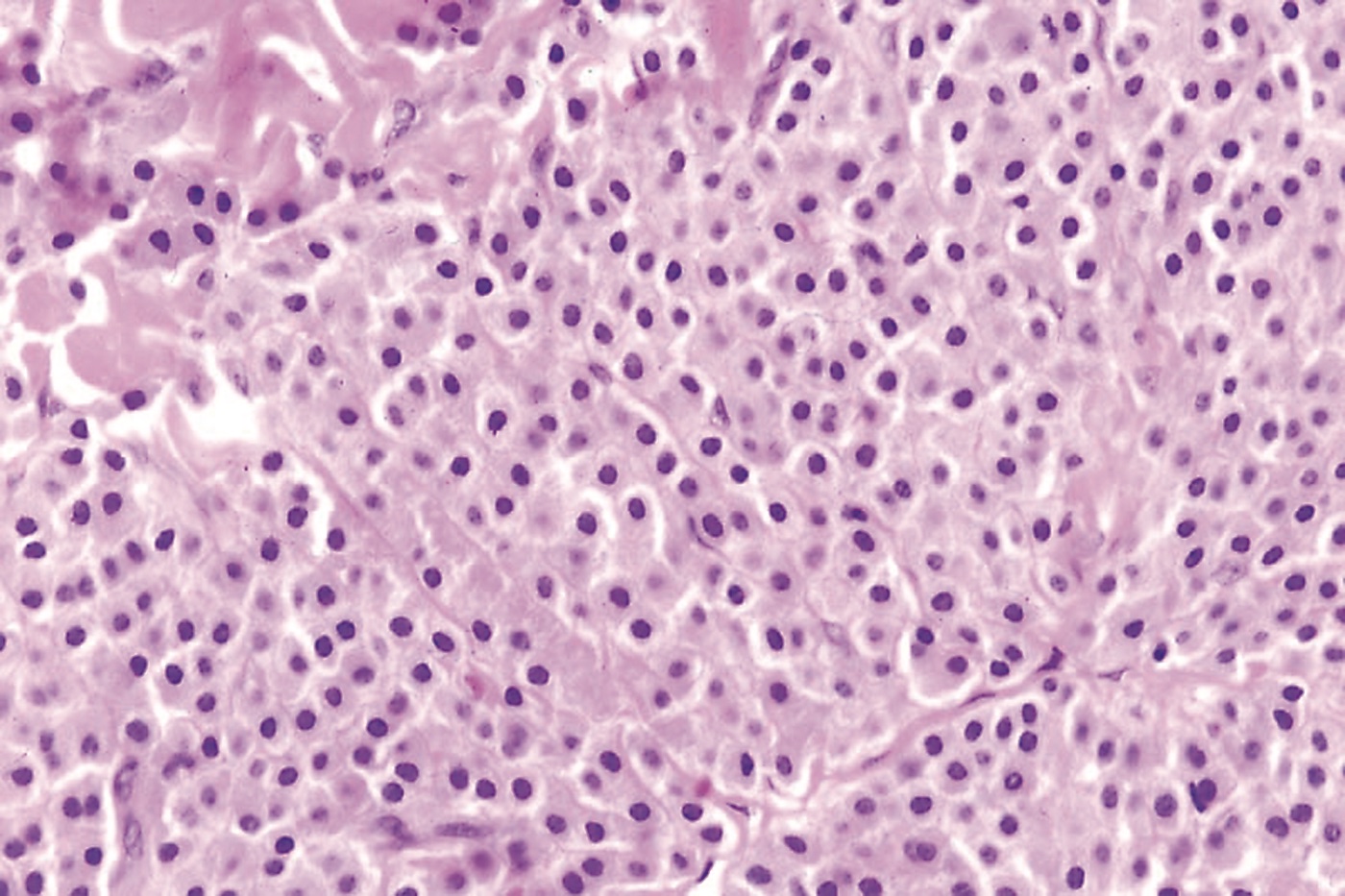 0608CFP_CP_Mastocytoma_3b