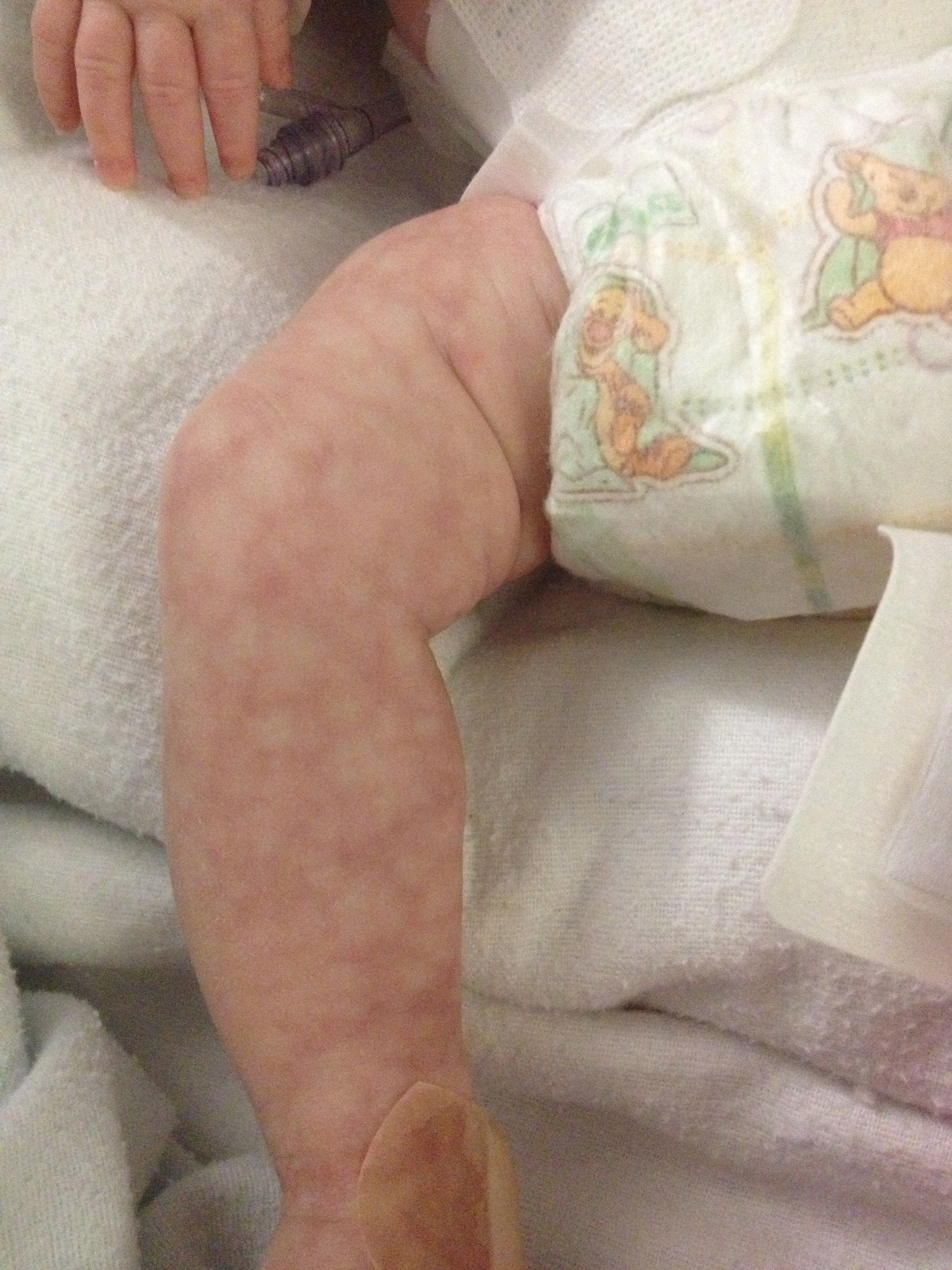 What Is The Cause Of This Infant s Mottled Appearance Consultant360 What Is The Cause Of This Infant s Mottled Appearance Consultant360