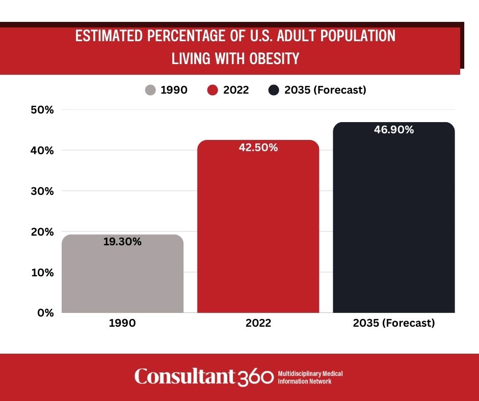 State level prevalence of obesity graphic