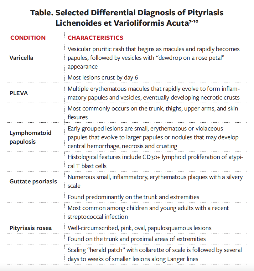 Table. Selected Differential Diagnosis