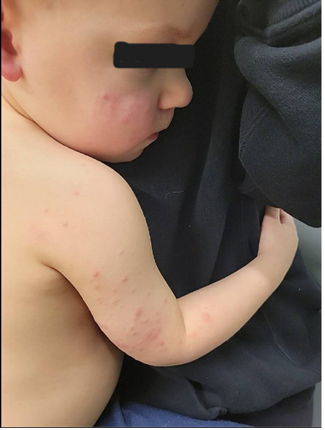 Fig. 1. Posterior right arm