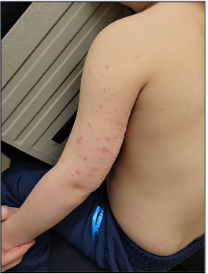 Fig. 2. Posterior left arm