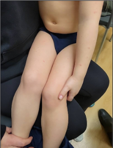 Fig. 3. Anterior trunk and thighs 