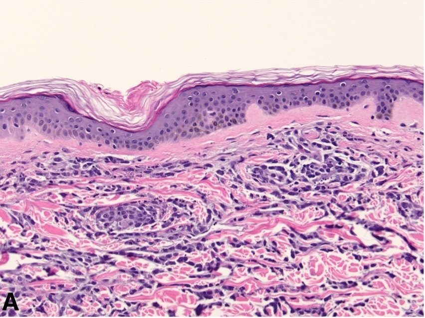 Hematoxylin and eosin (H&E) 20x objective magnification 