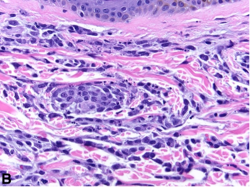 H&E 40x objective magnification are shown. 