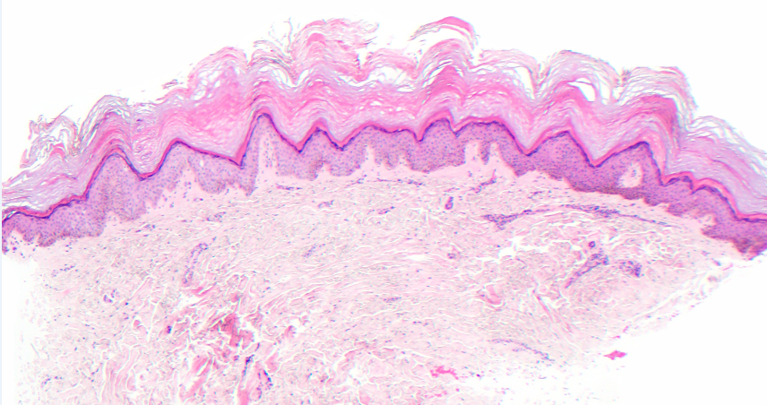Figure 5. Histopathology, H & E stain, shown at 40x.