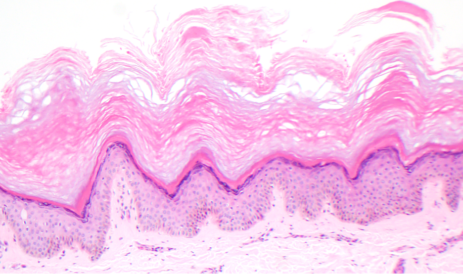 Figure 6. Histopathology, H & E stain, shown at 100x.