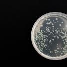 Bacteria in a petri dish. 
