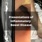 IBD Slideshow