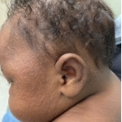 side view of infant's head