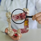 Magnifying glass examining a model of the colon