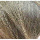 Does This Woman Have Head Lice