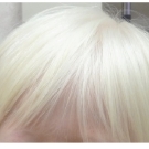 What’s the Cause of This Girl’s White Hair, Milky Skin, and Blue Eyes?