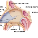 Nasal Septal Perforation