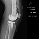 Streptococcus canis Infection