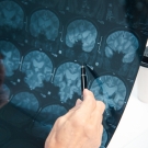 clinician examining brain scans