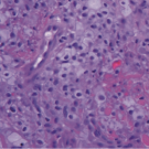 A Collection of Dermatologic Disorders