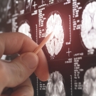 MRI scans of the human brain