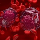 Chronic Lymphocytic Leukemia 