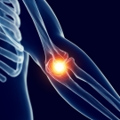 image of elbow pain
