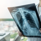 Doctor examining a chest x-ray