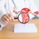 doctor holding magnifying glass over a model of a uterus