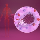 Image of a body with close-up of Chronic Lymphocytic Leukemia cells