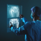 doctor looking at xray