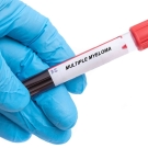 multiple myeloma blood vial