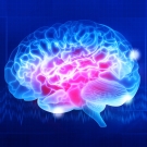 Brain image