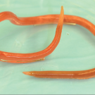 Pinworm from a man's anus