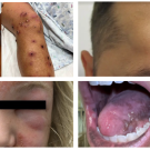 four dermatological cases