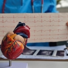 doctor holding electrocardiogram in front of model heart
