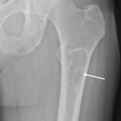 Initial plain radiograph 