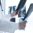 doctor holding xrays