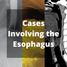Esophagus